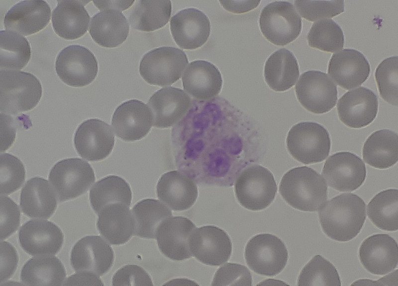 A view through a microscope showing several round, gray cells with a cluster of purple cells in the middle.