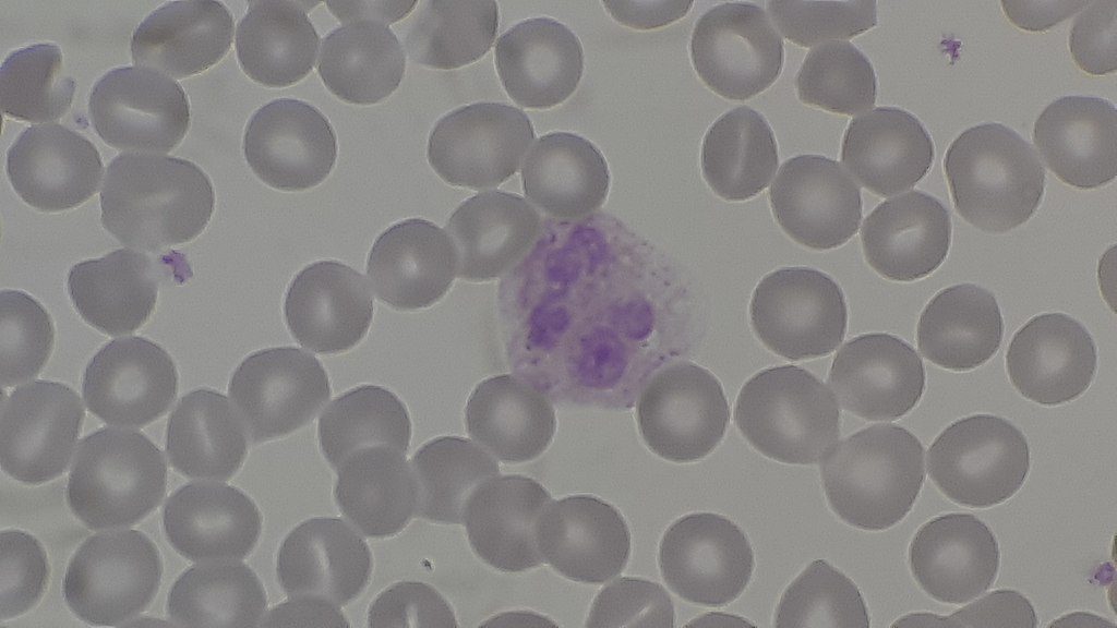 A view through a microscope showing several round, gray cells with a cluster of purple cells in the middle.
