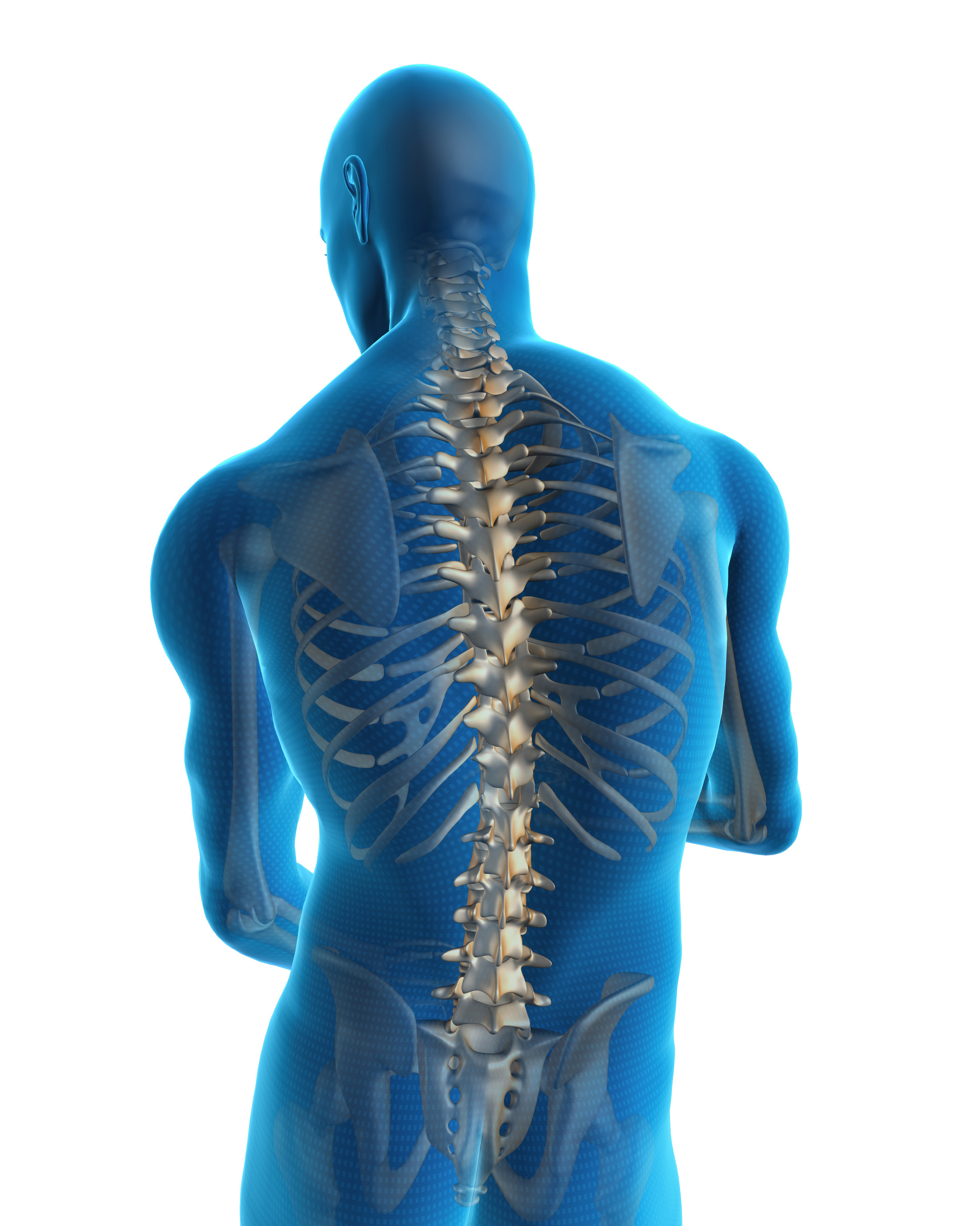 Image of a back in pain